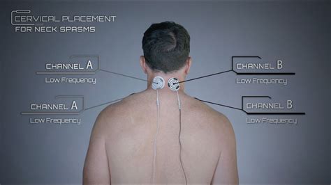 The structures of the human neck are anatomically grouped into four compartments; Cervical Placement for Neck Issues Example - YouTube