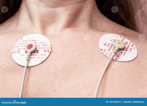 Electrodes Of An Electrocardiograph Are Glued On A Woman Chest