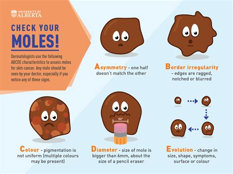 Why Do We Have Moles On Our Body How To Stay Healthy For Life