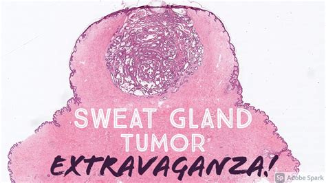 Sweat Gland Tumor Extravaganza 31 Slides Pathology Dermpath