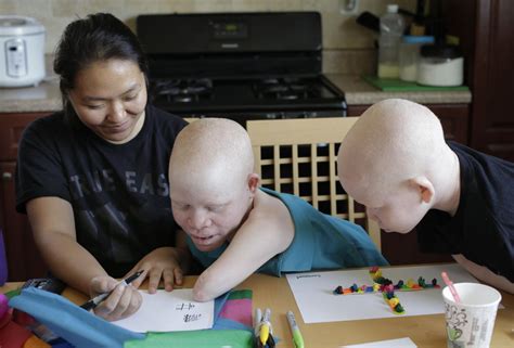 Africas Hunted Albino Children Whose Body Parts Are Prized On The