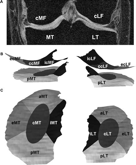 Subregional Femorotibial Cartilage Morphology In Women Comparison