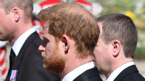 Is Prince Harry Losing His Hair Faster Since Moving To America Hot