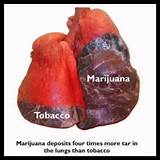 Images of Does Marijuana Cause Cancer