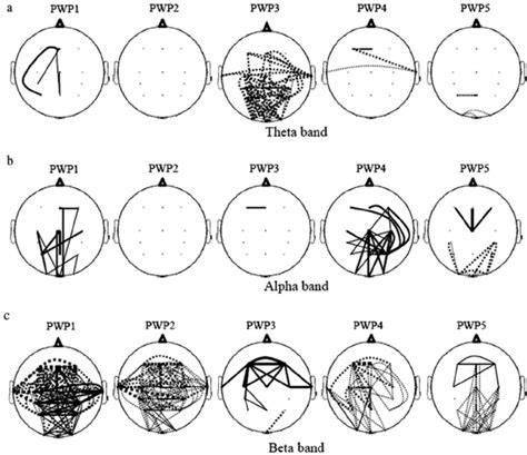 Scalp Maps Showing Statistically Significant Changes In Eeg Coherence