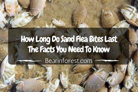 How Long Do Sand Flea Bites Last The Facts You Need To Know
