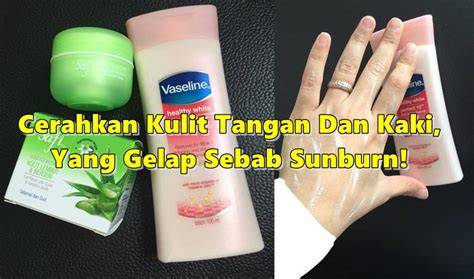 Hari ni saya nak share tentang cara cerahkan kulit dan kurangkan parut jerawat. Cara Mudah Cerahkan Kulit Tangan Dan Kaki, Yang Gelap ...