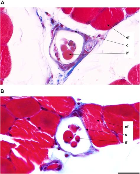 Frontiers Evaluating Sexual Dimorphism Of The Muscle Spindles And Intrafusal Muscle Fibers In