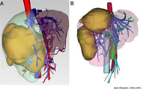 3d Diagram Of The Liver Bioengineering Free Full Text Bioprinting For