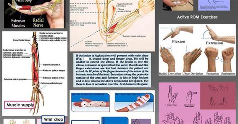 Radial Nerve Palsy Exercise Health Pinterest Occupational Therapy