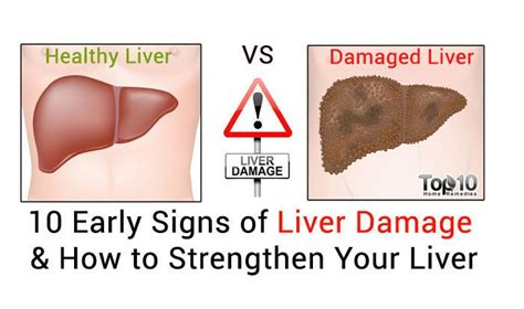 The most common type of liver cancer is hepatocellular carcinoma, which begins in the main type of liver cell (hepatocyte). 10 Early Signs of Liver Damage & How to Strengthen Your ...