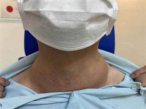 Dr Dennis Chuas Complete Guide To Neck Lump Issues In Singapore