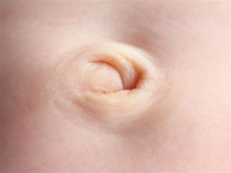 Will My Babys Belly Button Always Stick Out Babycenter