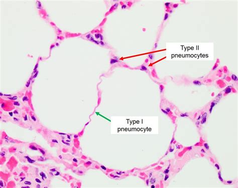 Type 1 And Type 2 Alveolar Cells
