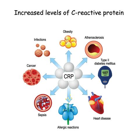 C Reactive Protein Or Crp Normal Levels Chart For Adults