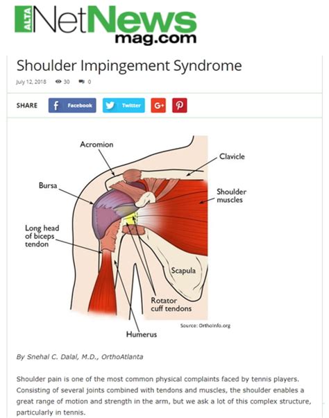 Diagram Of Shoulder Impingement Shoulder Pain Treatment Learn What