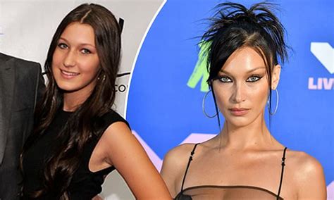 Plastic Surgeon Reveals Which A Listers From Bella Hadid To Khloé