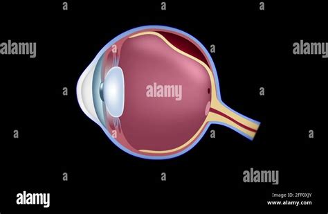 Diagram Retinal Detachment Stock Videos And Footage Hd And 4k Video