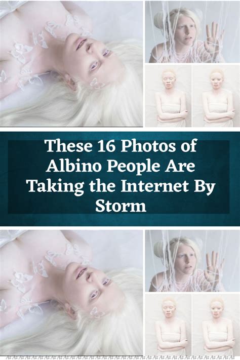 These Photos Of Albino People Are Taking The Internet By Storm Artofit