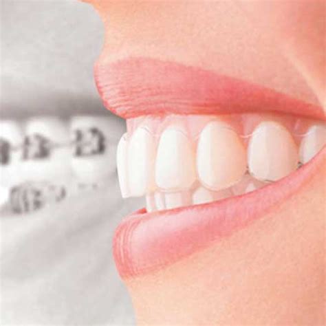 Can You Smoke With Invisalign West Hollywood Holistic And Cosmetic