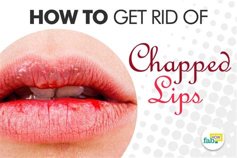How To Get Rid Of Chapped Lips 4 Easy Methods Fab How