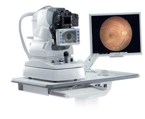 Retinal Digital Imaging Markham Optometrist