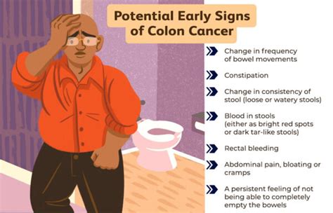 Colon Cancer Symptoms Stages And Treatment