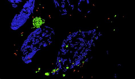 Utilizing Super Resolution Microscopy For Cellular Dynamics