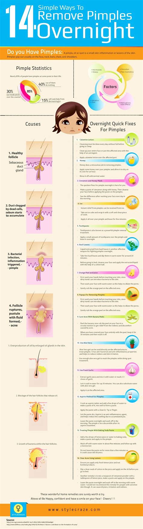 How To Get Rid Of Pimples Overnight Infographic How To Remove