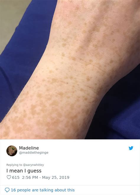People Are Freaking Out Over This Claim That All Women Have A Freckle On Their Wrist