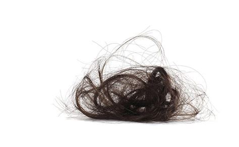 what it s like to live with trichotillomania a disorder where you pull your own hair out