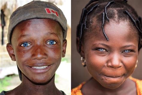 Black Africans With Blue Eyes Separating Myths From Facts Talkafricana
