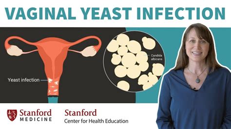Yeast Infection Vs Herpes Understanding The Differences In 2023