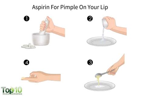How To Get Rid Of A Pimple On Your Lip Top 10 Home Remedies