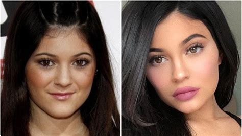 Kylie Jenner Reveals How Insecurity Made Her Change Her Lips Start A