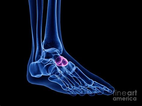 Navicular Bone Photograph By Sebastian Kaulitzkiscience Photo Library