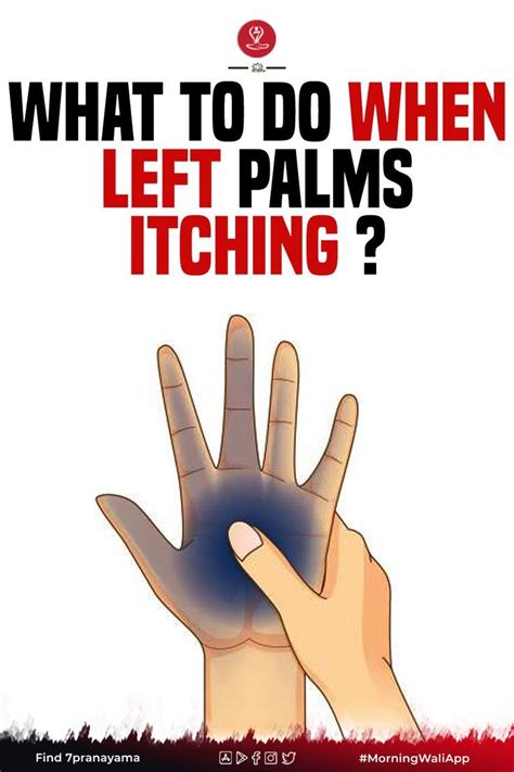 Palms Itching Itchy Right Palm Itchy Left Palm