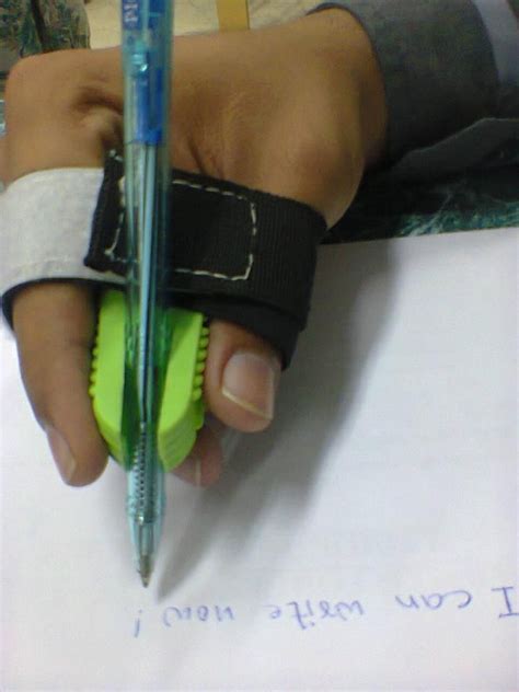 This Pencil Grip Enables This Individual To Write