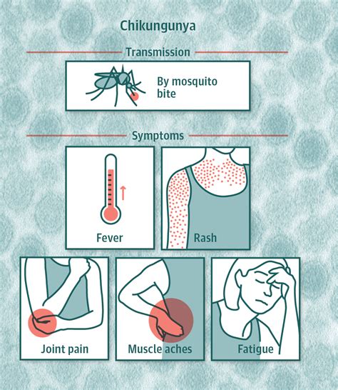Chikungunya Vaccine Trials Begin Global Health Jama The Jama Network