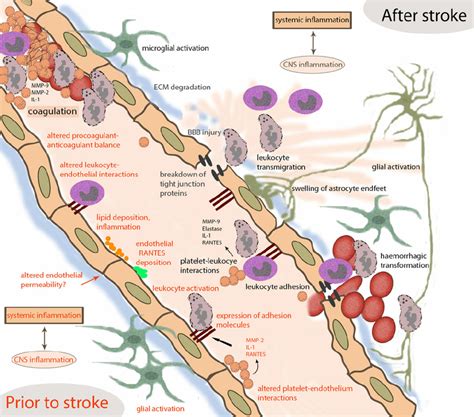 Vascular Effects Of Systemic Inflammation Before And After Stroke