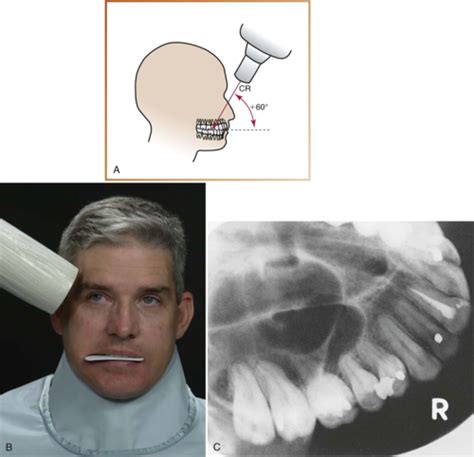 Dental Radiology Final Flashcards Quizlet