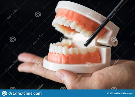 Dentist Demonstrate Lower Molar Tooth Stock Photo Image Of Crown