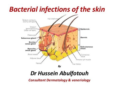 Bacterial Infections Of The Skin Pictures