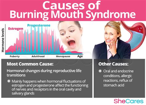 Burnical Burning Mouth Syndrome Symptoms Causes And T