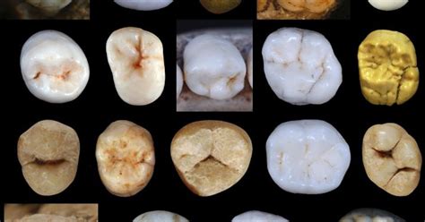 Ancient Teeth Reveal The Ancestor Humans Likely Share With Neanderthals