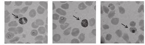 Plasmodium Falciparum Morphology After 24 H Of Incubation With The