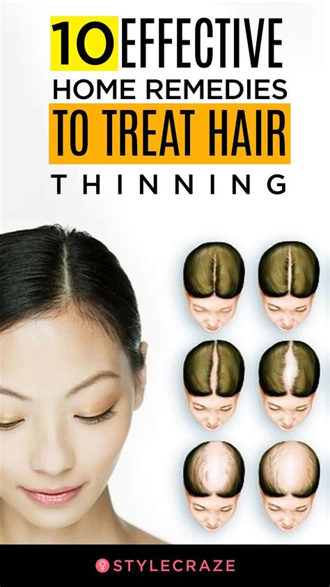 What Can You Do About Thinning Hair In 2023 Best Simple Hairstyles For Every Occasion