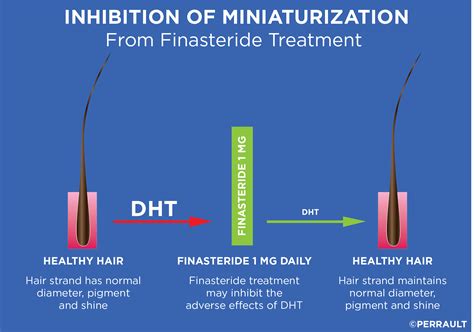 .5mg pills of avodart (dutasteride) is what it comes in, and yes it is bad to remove that much dht from your body, and it wont make a difference on hair that you will see. Finasteride & Dutasteride | GL Perrault MD | Hair Loss and ...