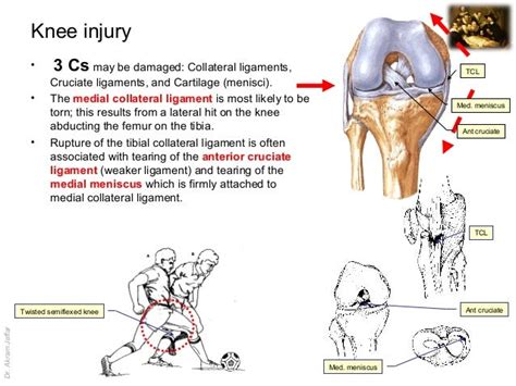 Knee Anatomy Injuries