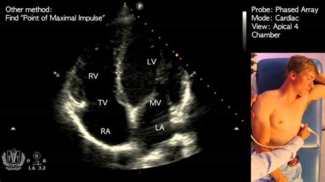 Trans Thoracic Echocardiography Images Apical Four Chamber Views My